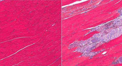 Researchers discover a key to making new muscles