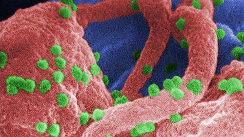 Undiagnosed acute HIV rates higher than expected in 'low prevalence' areas