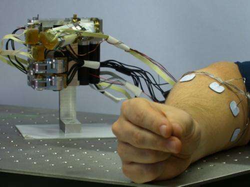 Researchers develop ultramodern forearm prosthesis