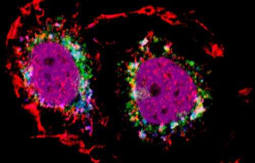 Scientists discover new mechanism which causes the spread of breast cancer
