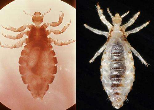 1 species, 2 outcomes: Team seeks source of body louse pathology