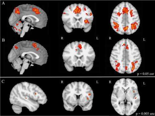 Brain imaging shows enhanced executive brain function in people with musical training