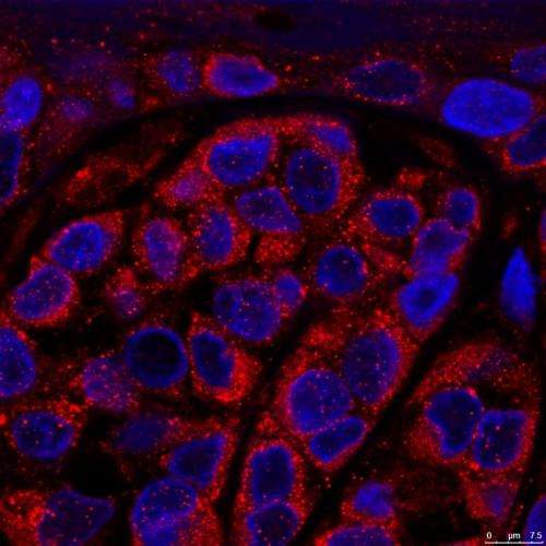 CNIO researchers discover more than 40 melanoma-specific genes that determine aggressiveness