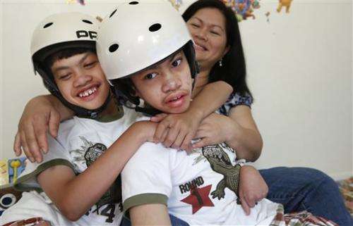 Decade on, separate lives for once-conjoined twins