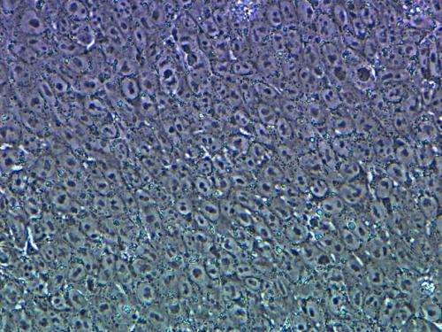 Discovery may make it easier to develop life-saving stem cells