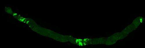 Flies with colon cancer help to unravel the genetic keys to disease in humans