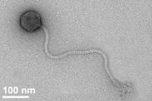 New, unusually large virus kills anthrax agent
