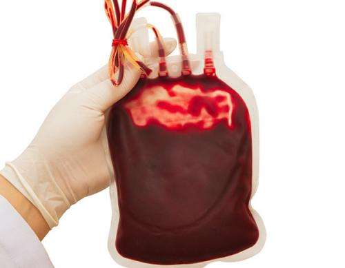 Patients given less blood during transfusions do well