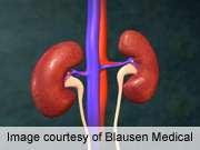 Personalized fluid levels cuts acute kidney injury
