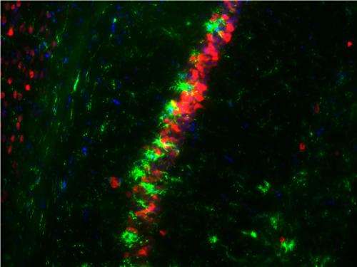 Researchers explore new possibilities for the treatment of epilepsy