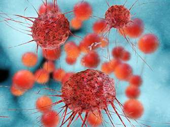 New technology developed to diagnose cancer cells