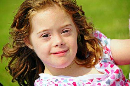Down syndrome teens need support, health assessed