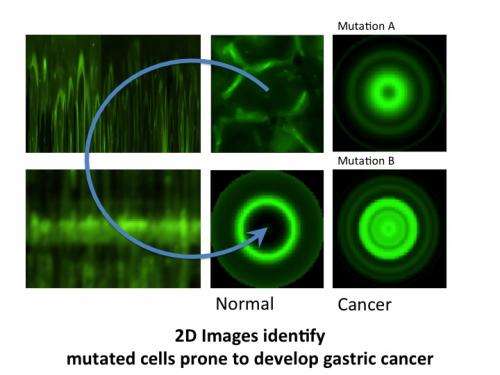 2D images as the new tool for cancer prevention