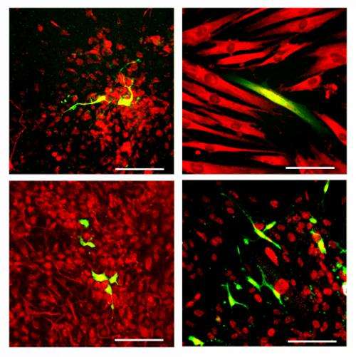 Biologists reprogram skin cells to mimic rare disease