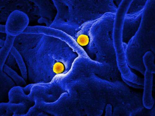NIH scientists establish new monkey model of severe MERS-CoV disease