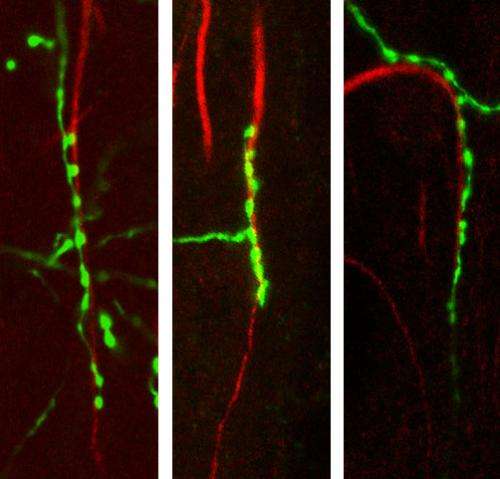 Scientists discover 2 proteins that control chandelier cell architecture