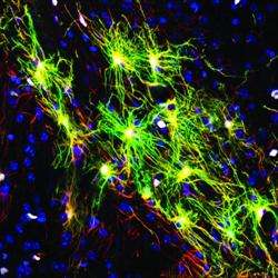 Stem Cell Therapies Hold Promise, But Obstacles Remain