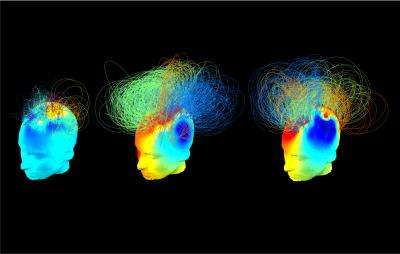 Scientists find 'hidden brain signatures' of consciousness in vegetative state patients