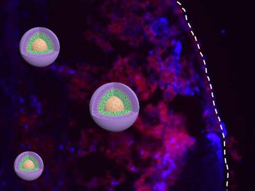 Study reveals optimal particle size for anticancer nanomedicines