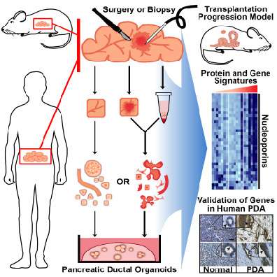 3-D culture system for pancreatic cancer has potential to change therapeutic approaches
