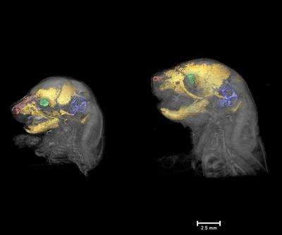 3-D imaging sheds light on Apert syndrome development