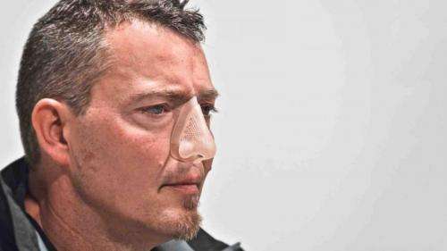 3D printed nose wins design award