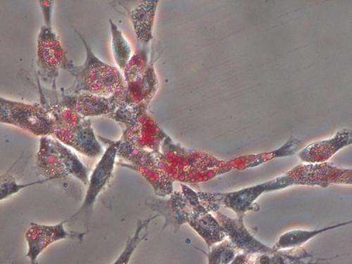 Bioengineers: Matrix stiffness is an essential tool in stem cell differentiation