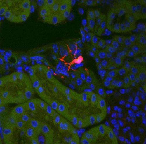 Identifying the cellular origin of fibrosis