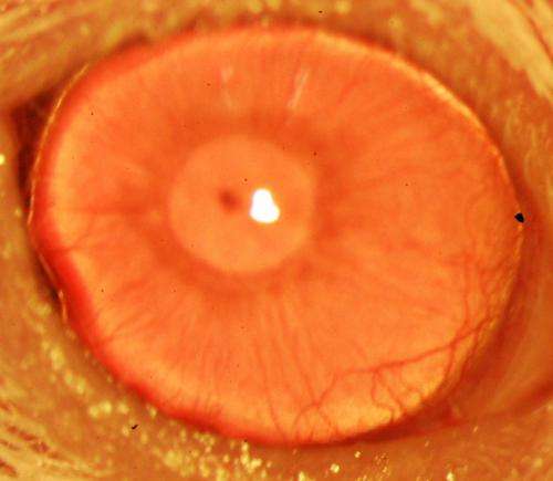 Scientists can now screen for stem cells that enhance corneal regrowth