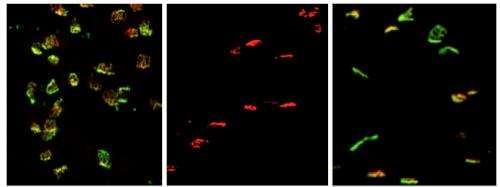 Study identifies gene tied to motor neuron loss in ALS