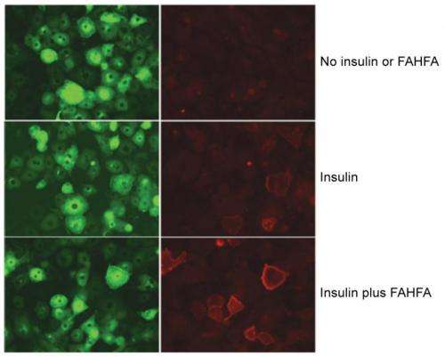 Scientists discover a 'good' fat that fights diabetes