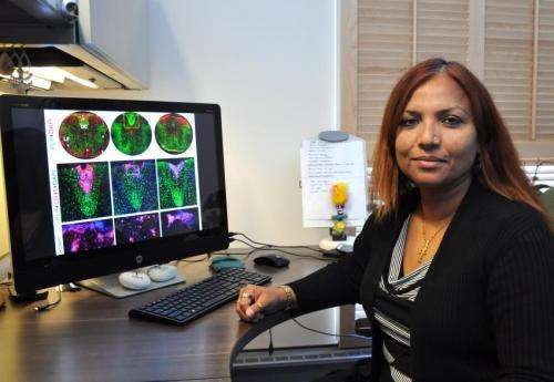 Researchers identify chemical compound that decreases effects of multiple sclerosis