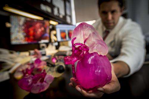 Understanding your kidney tumor in 3D