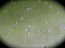 Study confirms that sperm quality decreases with age