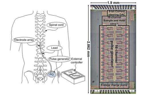 New technology reduces size of spinal stimulator implants