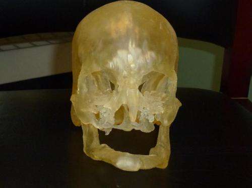 Researchers use 3-D printing to guide human face transplants