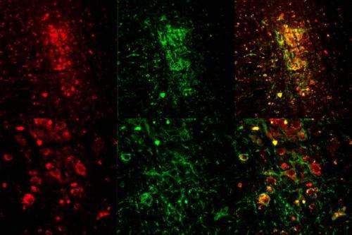 Researchers use optogenetics to trigger REM sleep in mice