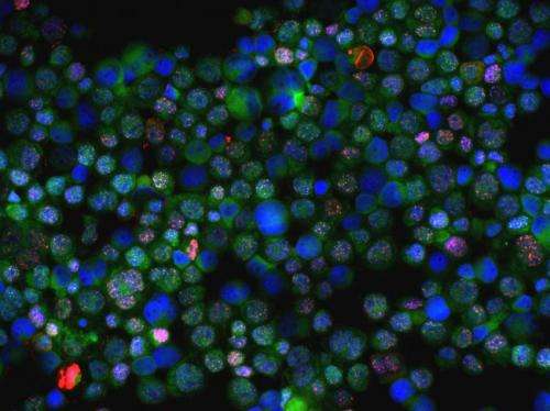International consortium discovers 2 genes that modulate risk of breast and ovarian cancer