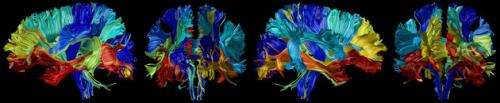 Scientists show rise and fall of brain volume