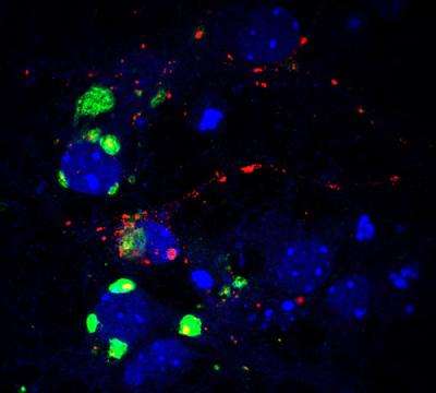 Researchers reveal the dual role of brain glycogen