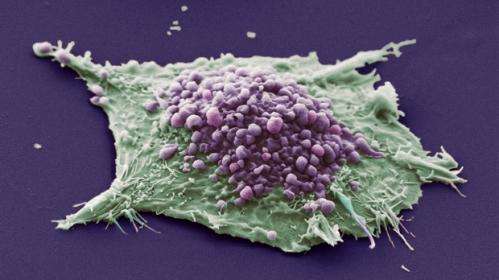 Scientists trigger self-destruct switch in lung cancer cells