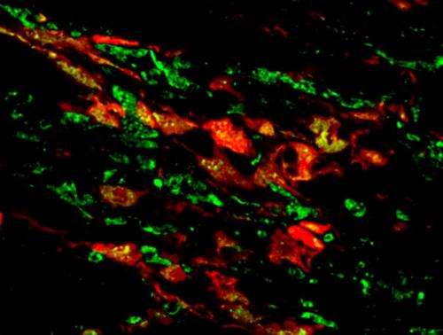 UNC researchers boost the heart's natural ability to recover after heart attack