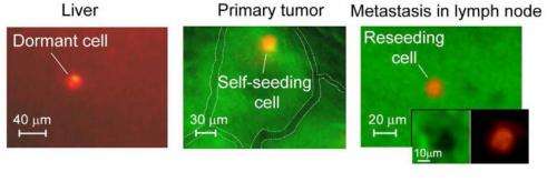 New technology using florescent proteins tracks cancer cells circulating in the blood