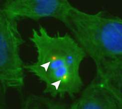 Researchers find protein 'switch' central to heart cell division