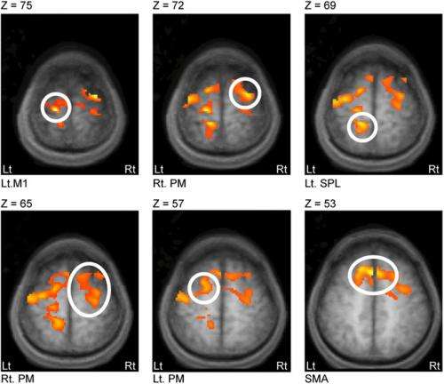 Connecting the dots: Water diffusion MRI reveals plasticity networks in remote nonstimulated brain regions