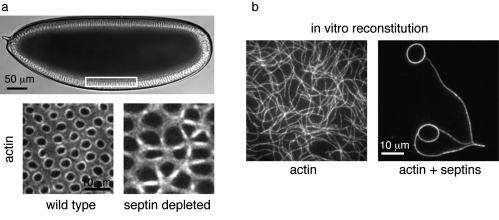 Actin ring assembly by septin proteins