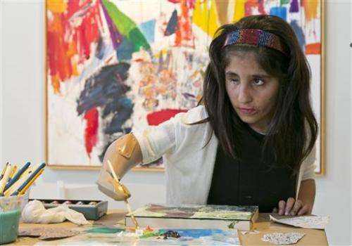 Afghan girl who lost arm paints with prosthetic