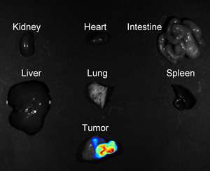 A fluorescent nanoprobe could become a universal, noninvasive method to identify and monitor tumors