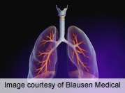 Airborne particulates beyond traffic fumes affect lung health