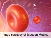 Anemia prevalent among older patients with diabetes